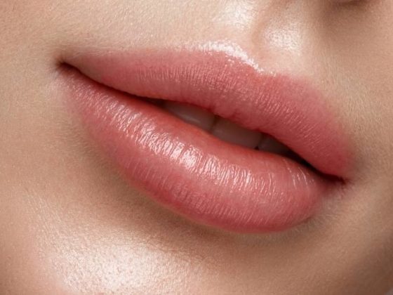 7 cosas que debes saber antes de un relleno de labios. Relleno de labios con ácido hialurónico.