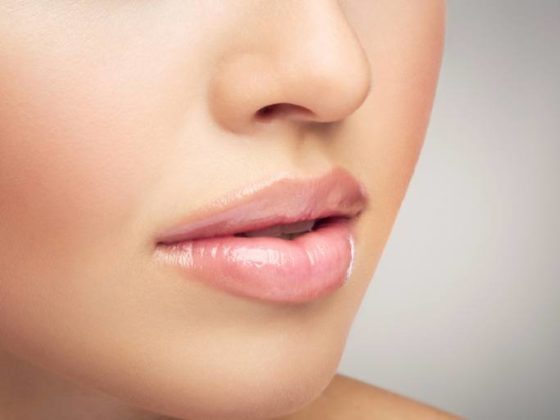 Diferencia entre labios rusos y relleno tradicional de labios