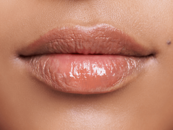 Habana Lips. Cuánto dura el relleno de ácido hialurónico para labios