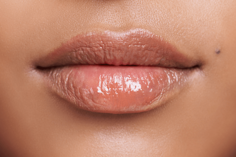 Habana Lips. Cuánto dura el relleno de ácido hialurónico para labios