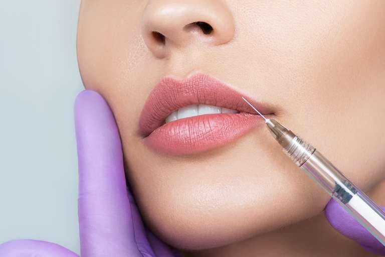 3 técnicas de aumento de labios