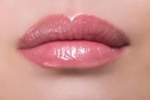 Recuperación después del relleno de labios ácido hialurónico