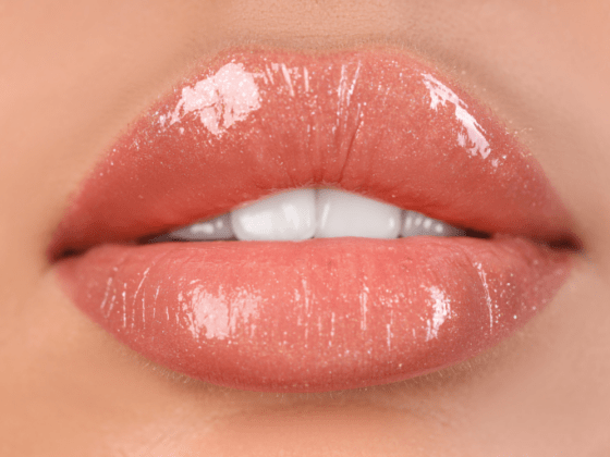 aumento de labios con ácido hialurónico en Madrid