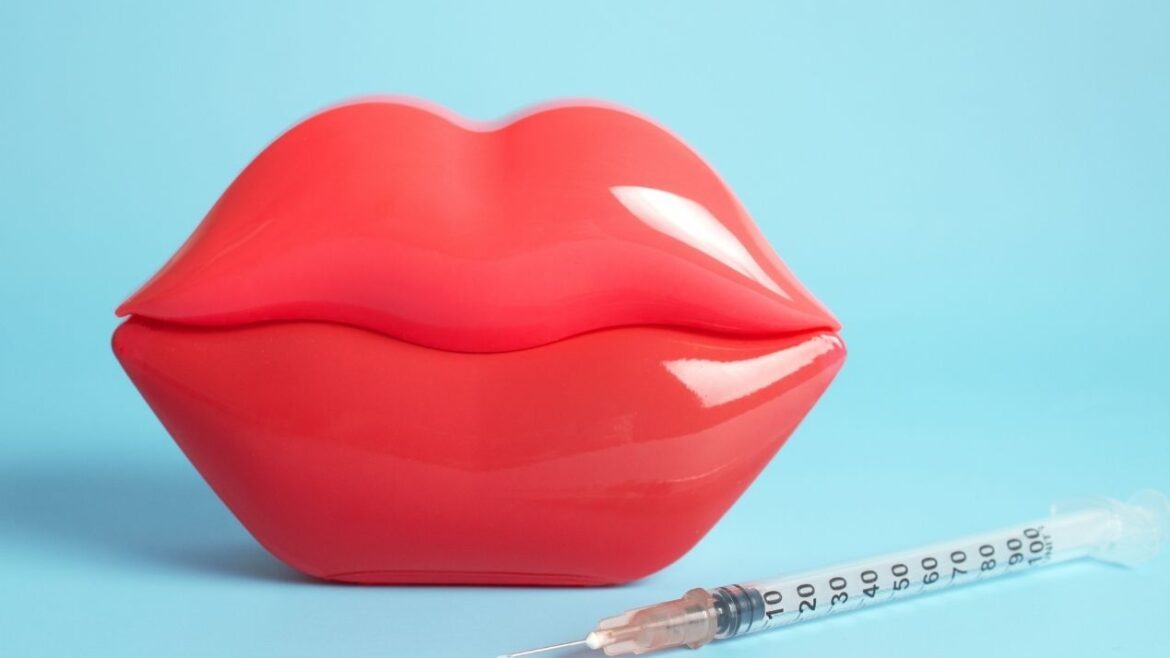 relleno de labios con ácido hiallurónico en madrid