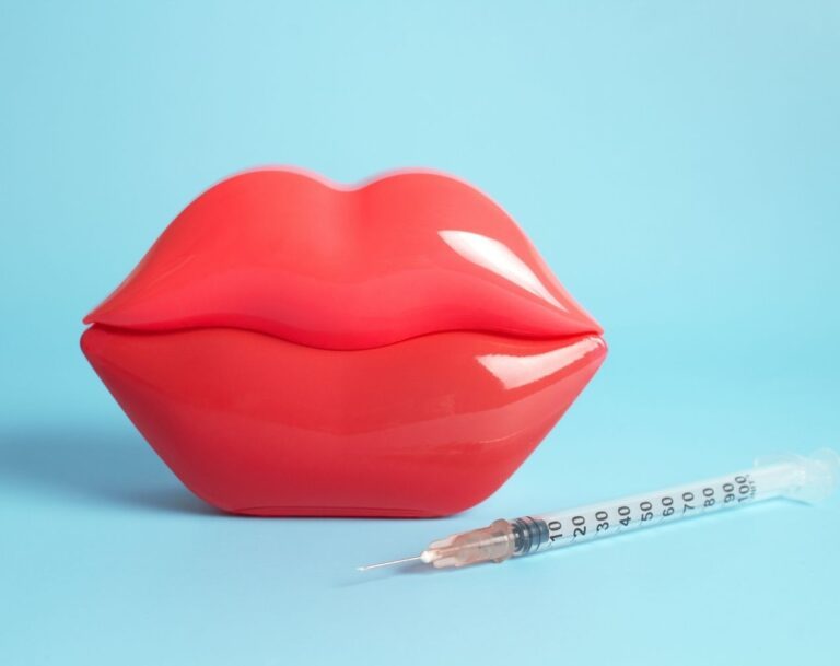 relleno de labios con ácido hiallurónico en madrid