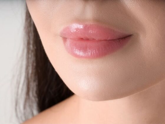 7 cosas que deberías saber sobre el relleno de labios con ácido hialurónico