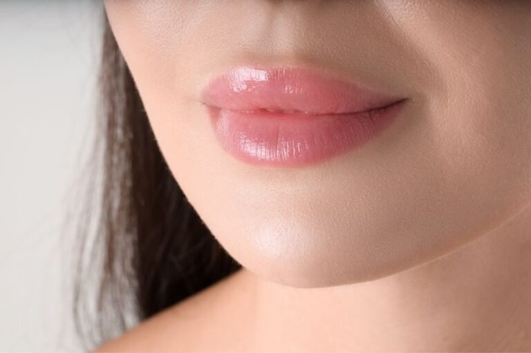 7 cosas que deberías saber sobre el relleno de labios con ácido hialurónico
